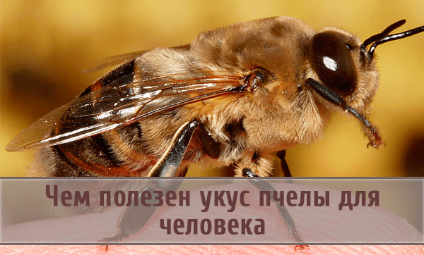 Киста гипофиза это и есть аденома Киста гипофиза это и есть аденома