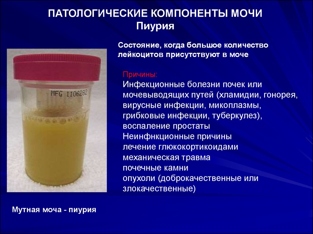Лейкоциты белок и бактерии в моче беременной 57