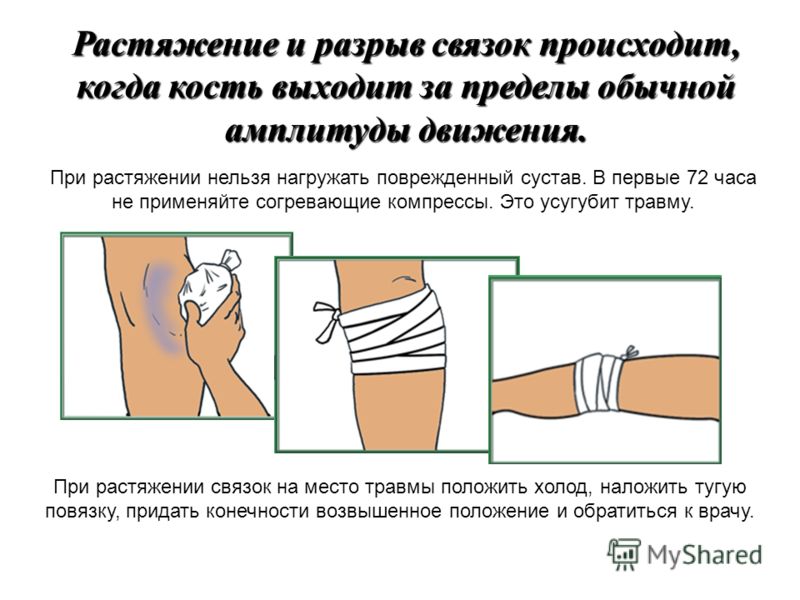 Воспаление связок и сухожилий суставов ног лечение Воспаление связок и сухожилий суставов ног лечение