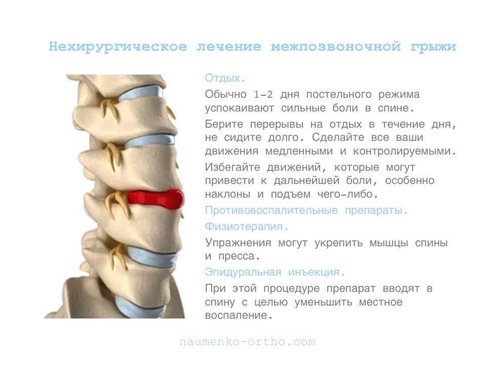 Лечение межпозвоночной грыжи поясничного отдела в домашних условиях