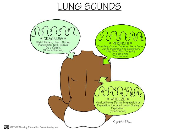 Best 25+ Lung sounds ideas on Pinterest Auscultating lung sounds - assessment Best 25+ Lung sounds ideas on Pinterest Auscultating lung sounds - assessment