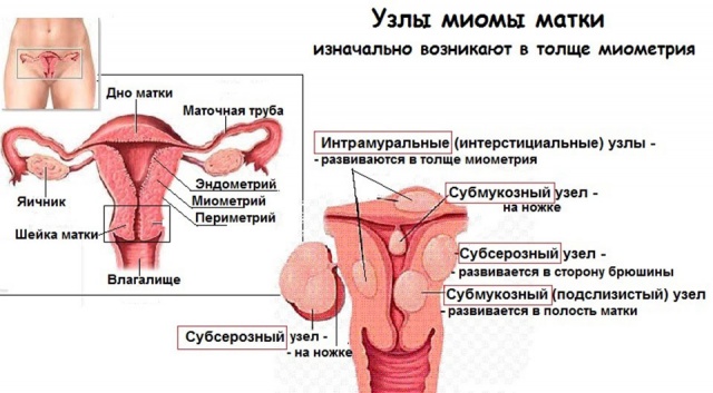 Корень бадана в гинекологии миома матки