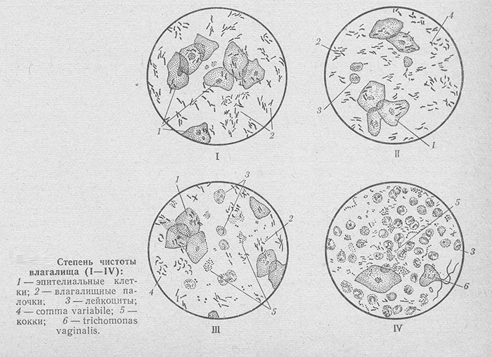 Гинекология лейкоциты в мазке