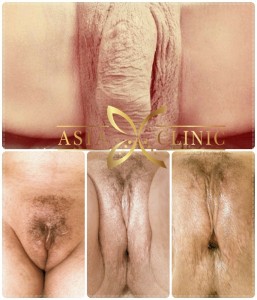 porn non vergine vergina and pinice facial recognition web search